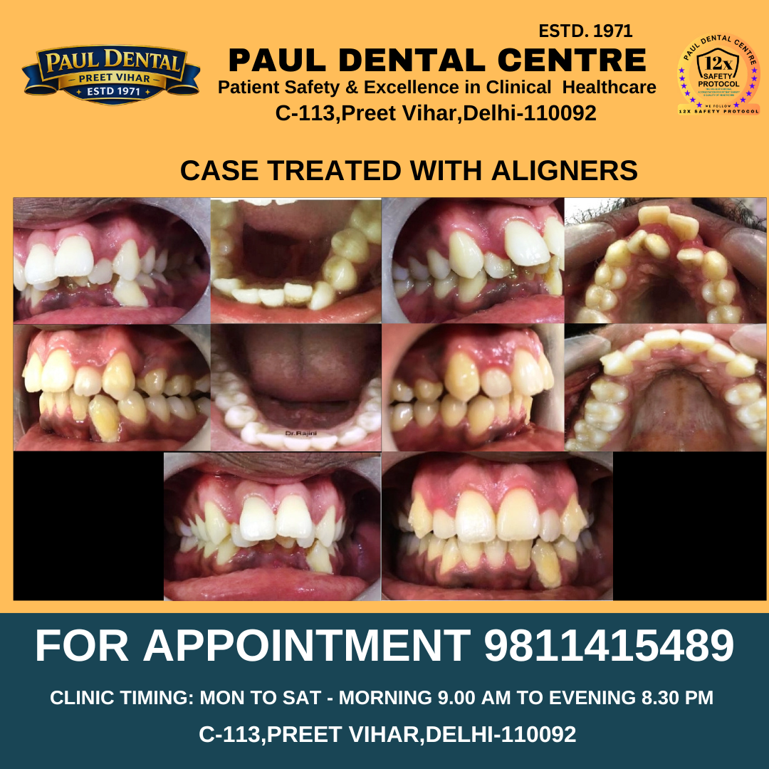 Case 32 – Paul Dental Center