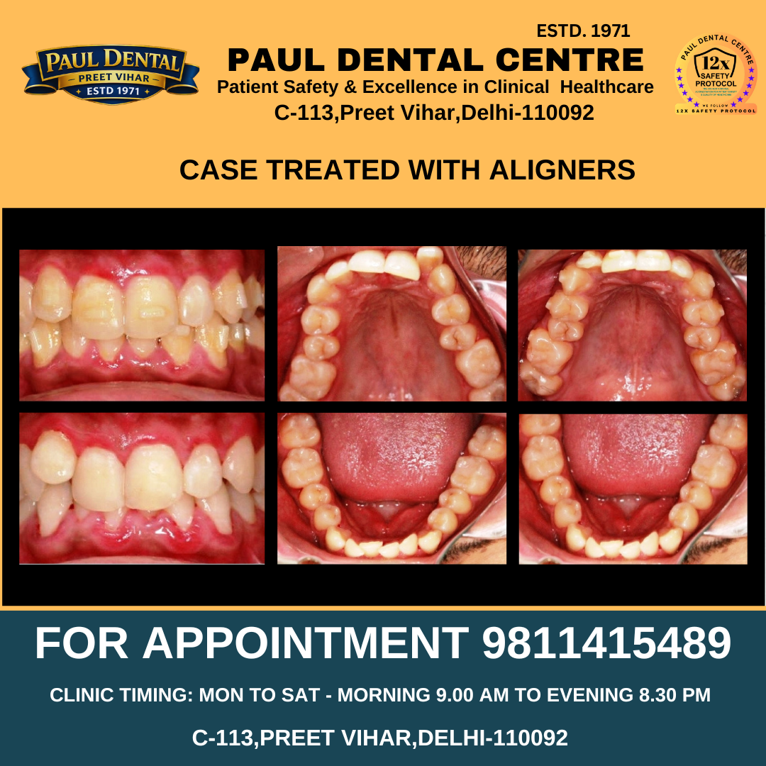 Case 36 – Paul Dental Center