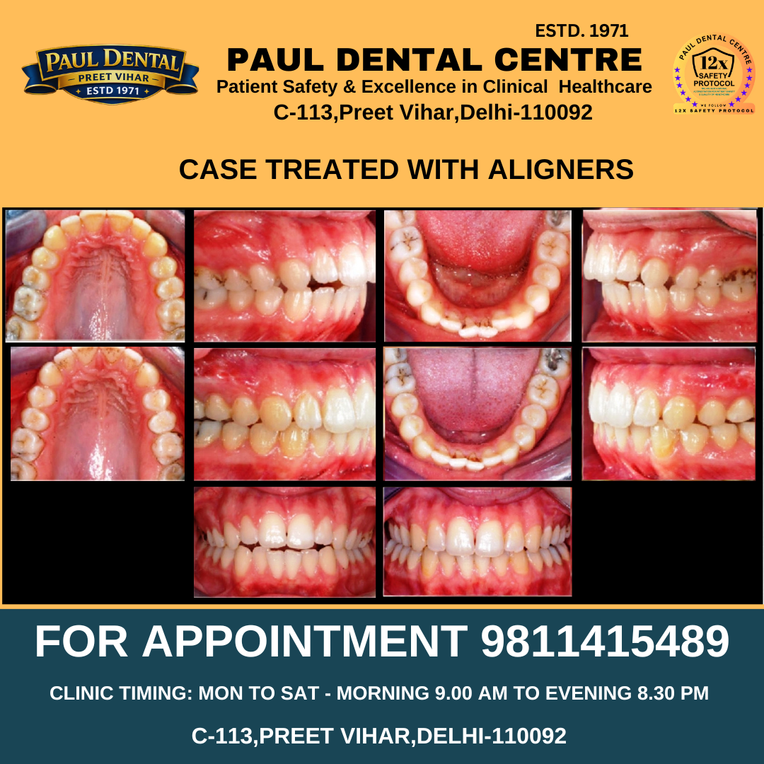 Case 39 – Paul Dental Center