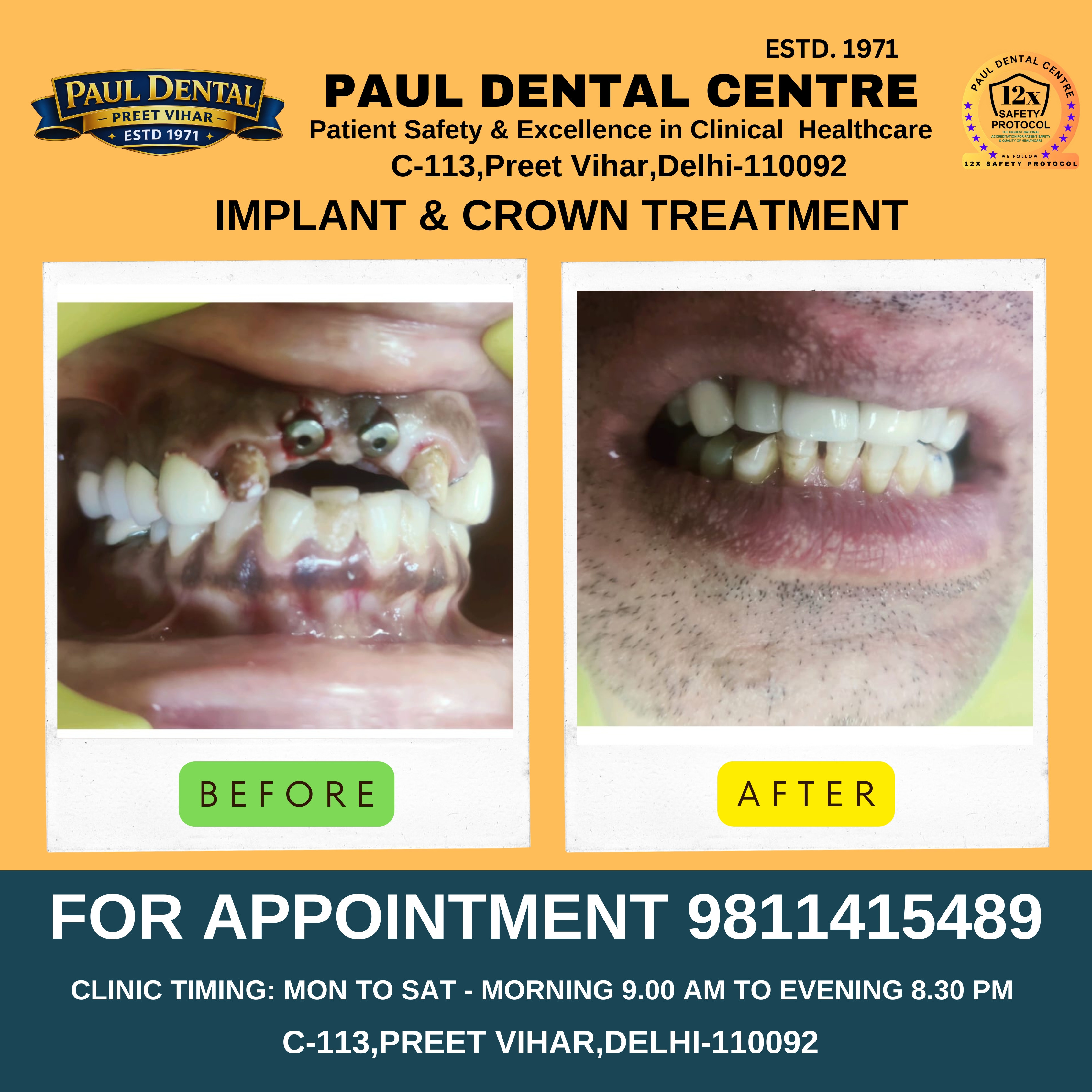 Case 4 – Paul Dental Center