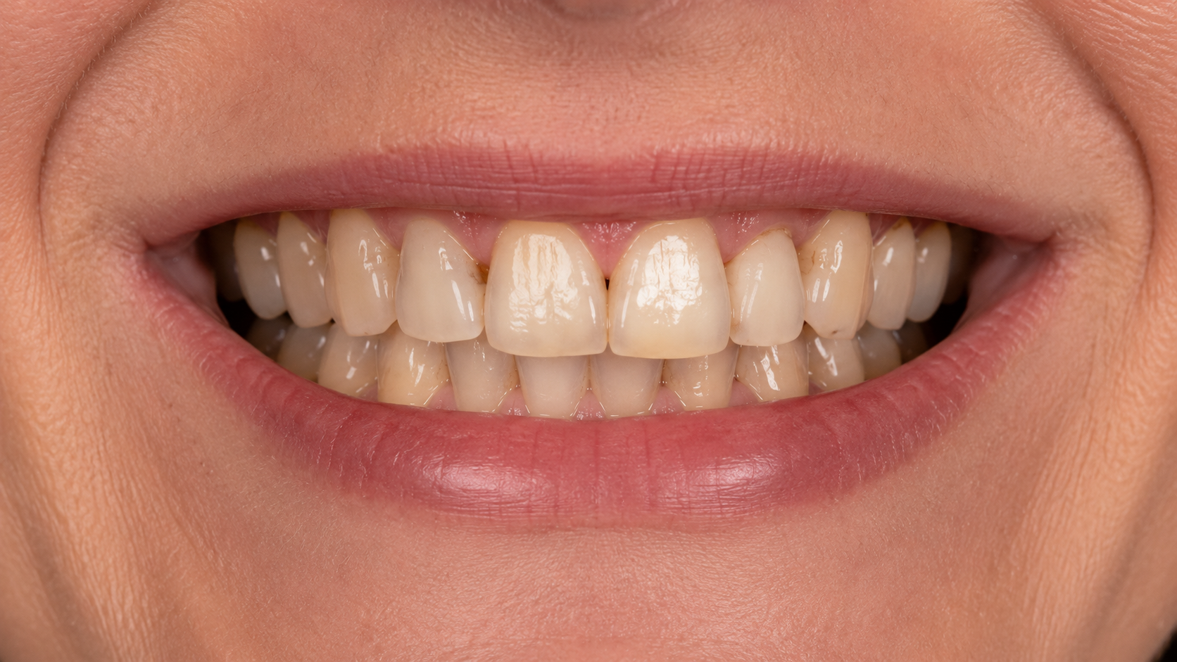Before Cosmetic Treatment