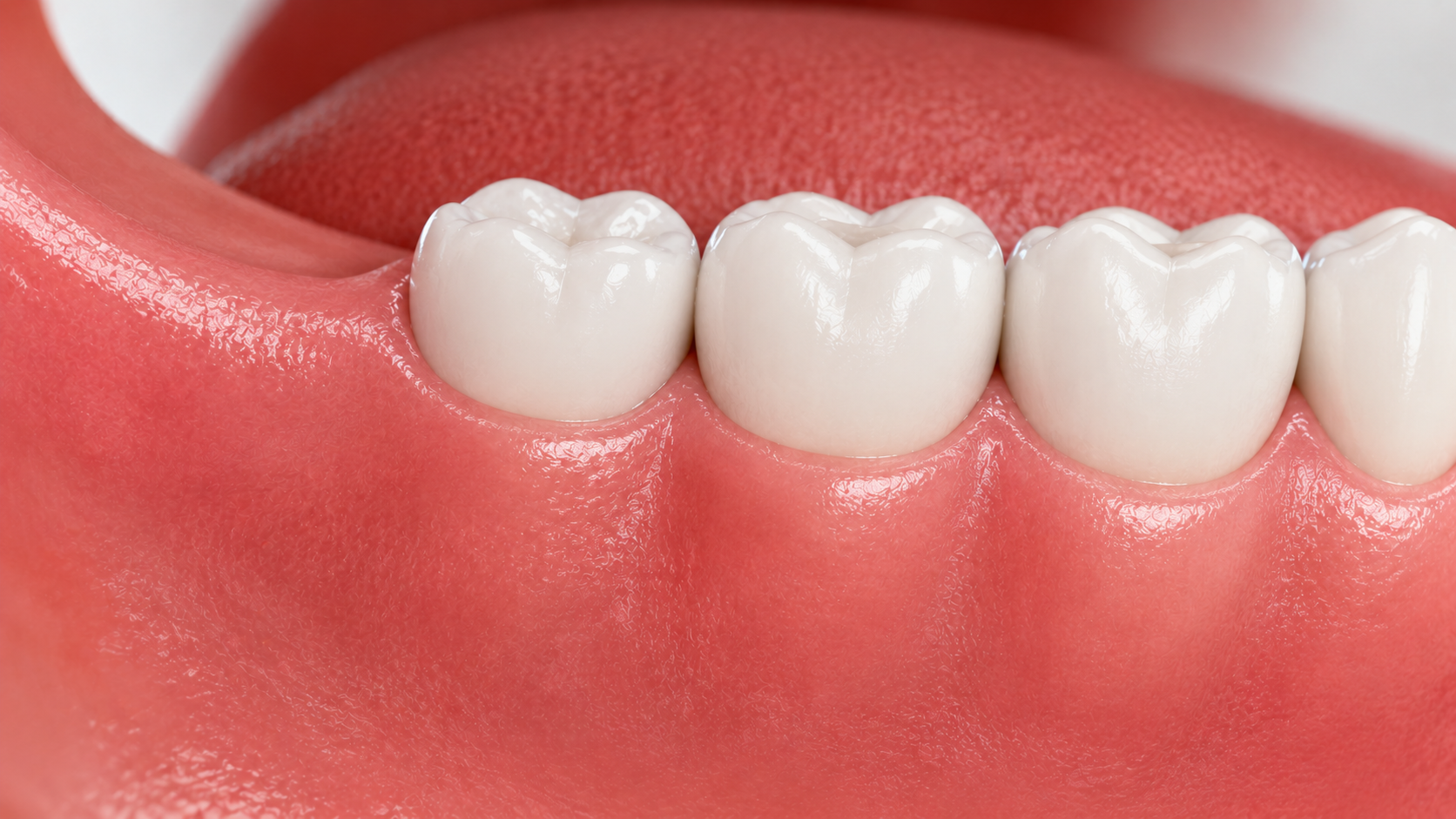 After Oral Surgery